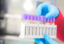 Оперативна інформація щодо поширення COVID-19 та пневмонії в Олександрії